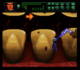 Rex Ronan : Experimental Surgeon [US] snes 1994 Game Image